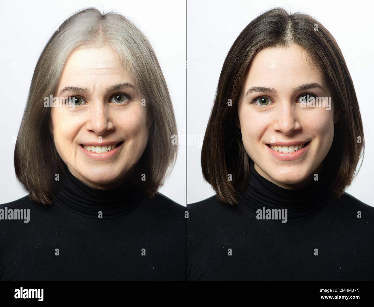 Woman before and after a rejuvenation treatment. Wrinkles, crow's feet, eyebags and age signs. Foreheads lines and grey hair. Stock Photo