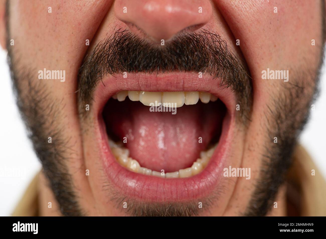 Mouth open wide woman closeup hi-res stock photography and images - Alamy