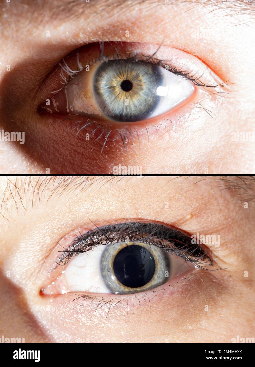 Human eye pupil change hires stock photography and images Alamy