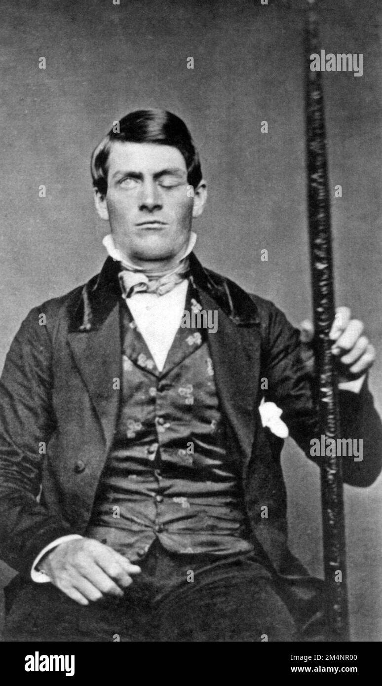 Phineas Gage. Photograph of Phineas P. Gage (1823–1860),  an American railroad construction foreman known for his improbable survival of an accident in which a large iron rod was driven completely through his head, destroying much of his brain's left frontal lobe. Stock Photo