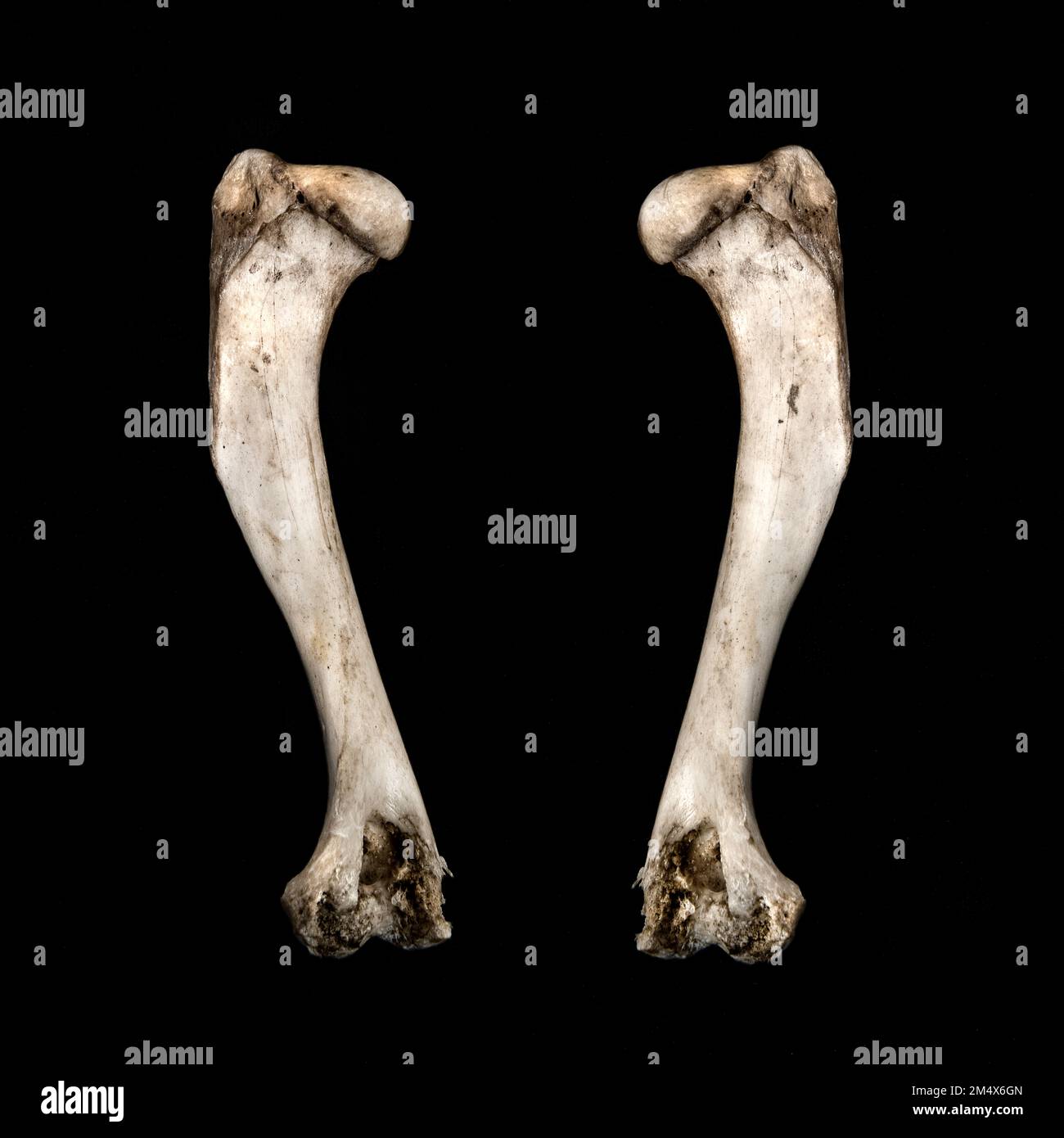 The femur hi-res stock photography and images - Alamy
