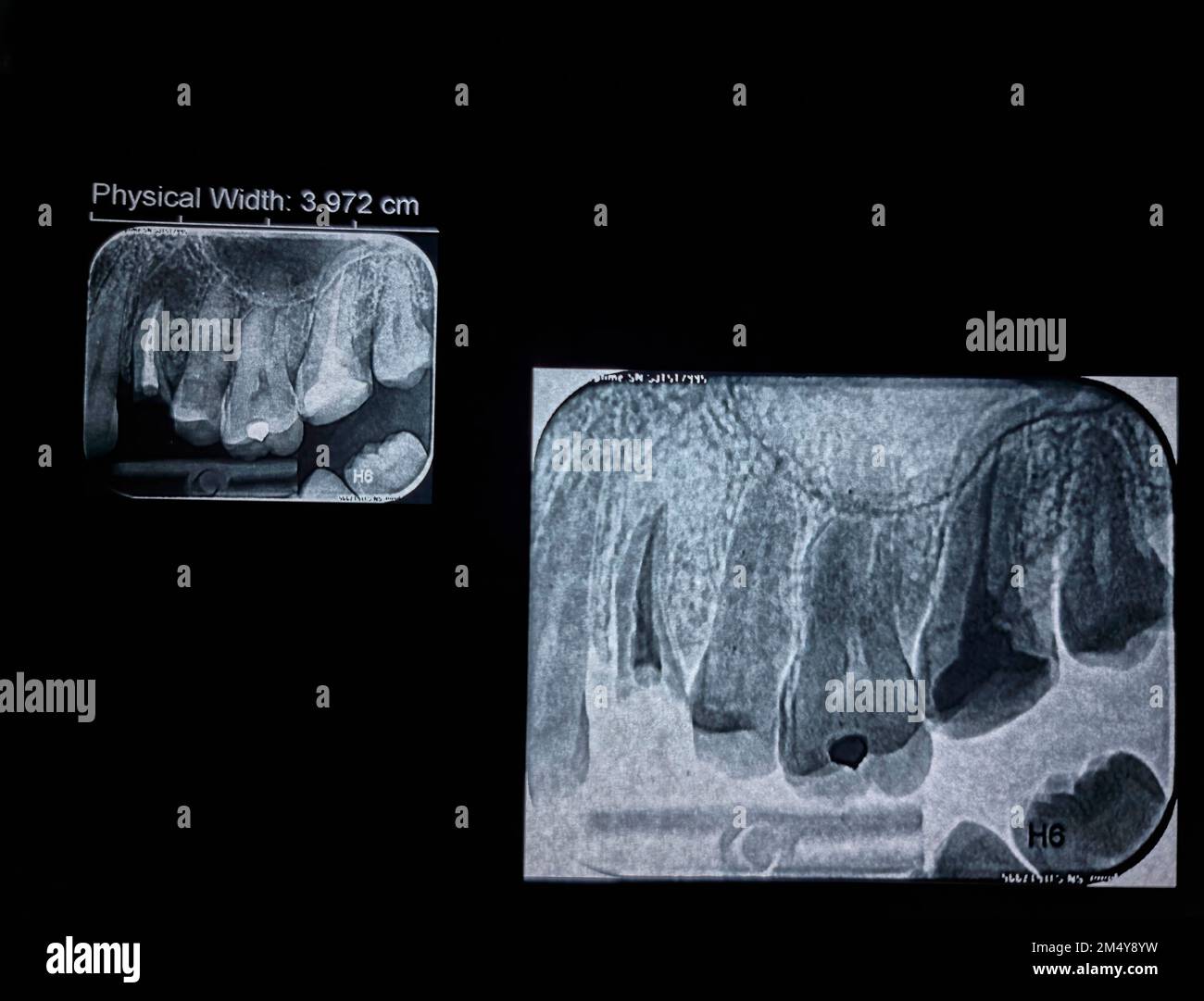 Dental xray image, teeth xray film Stock Photo Alamy