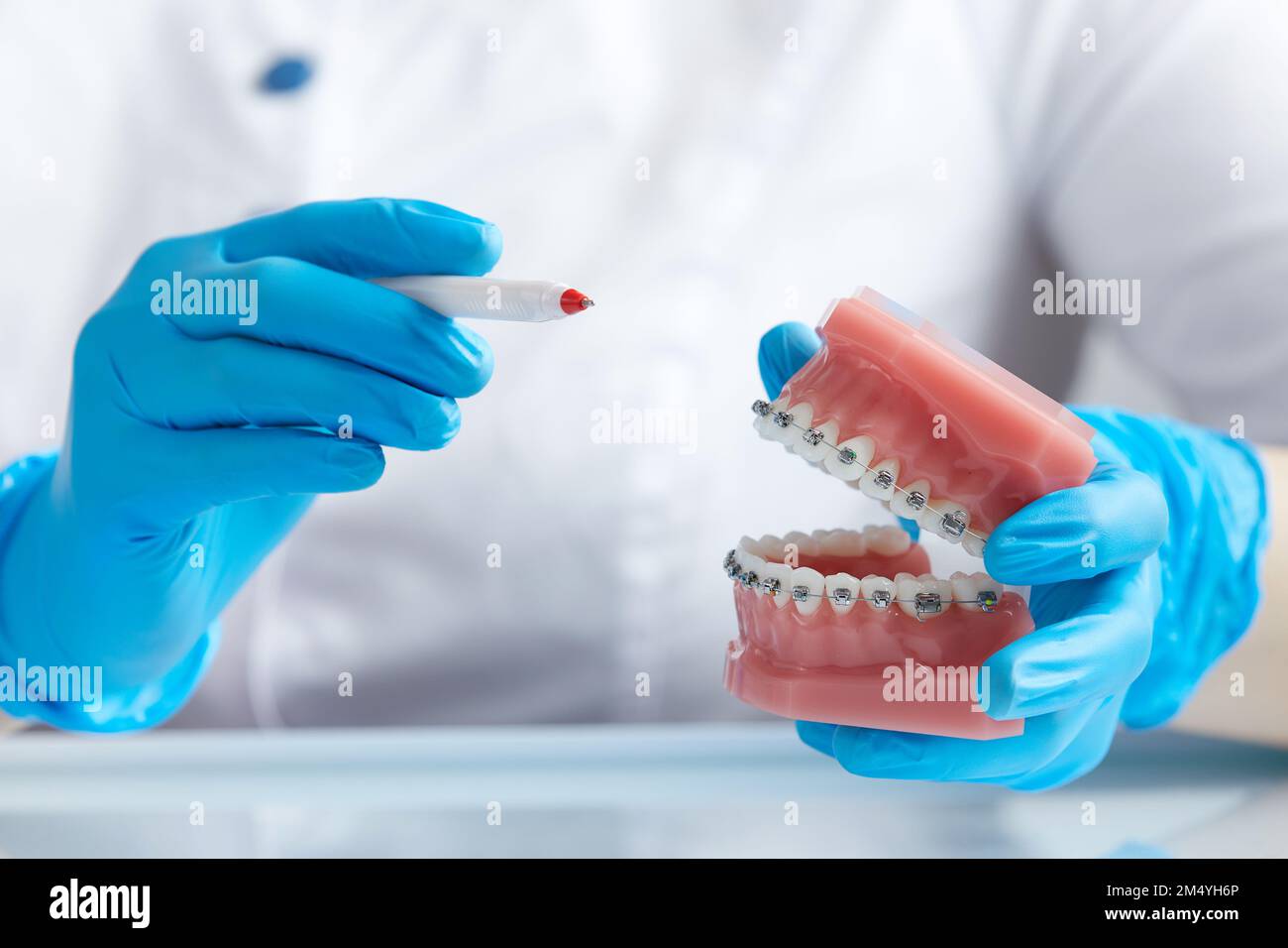 Doctor orthodontist showing model of human jaw with wire braces