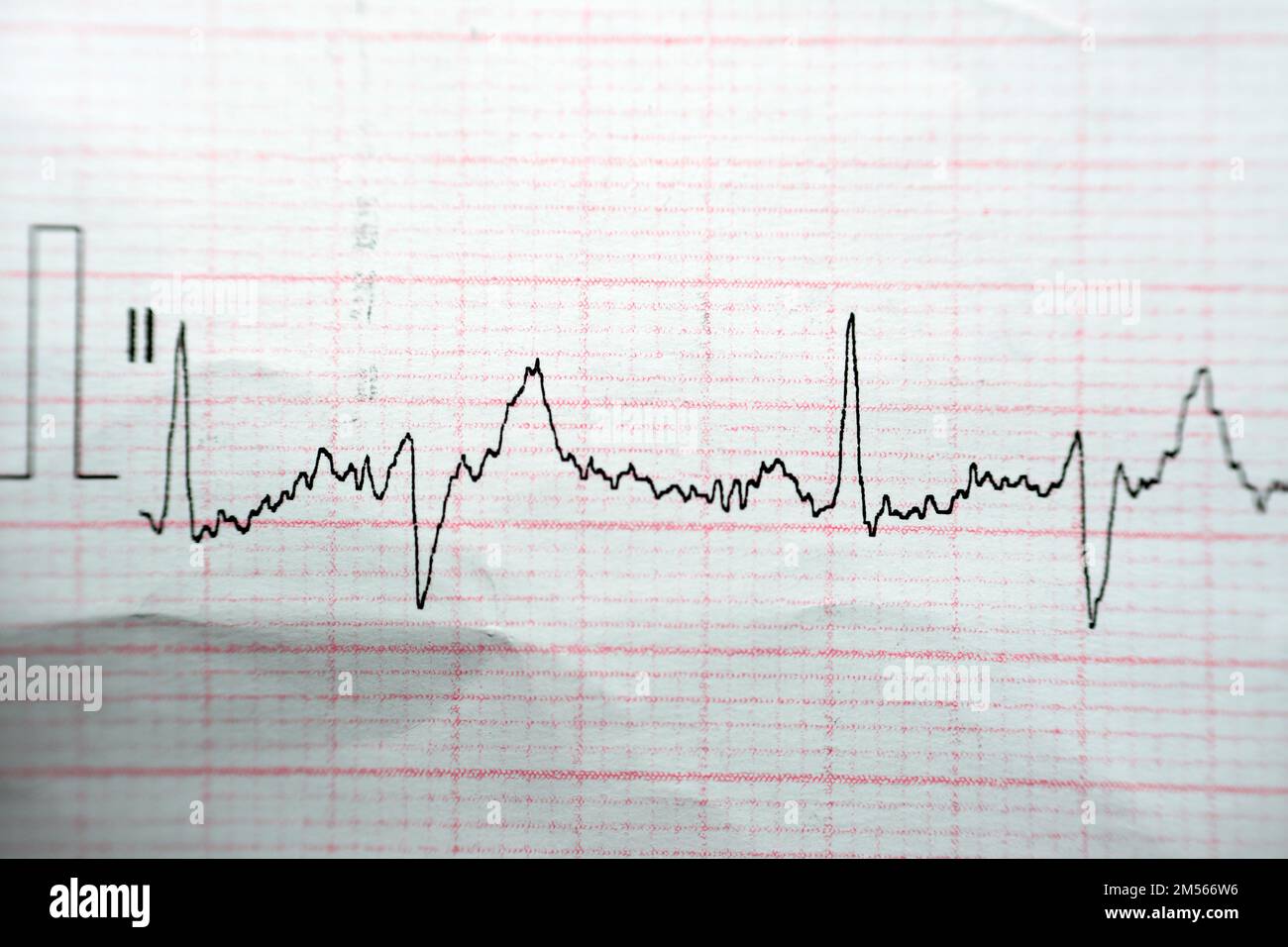 ECG ElectroCardioGraph paper that shows Normal Sinus Rhythm NSR with ...