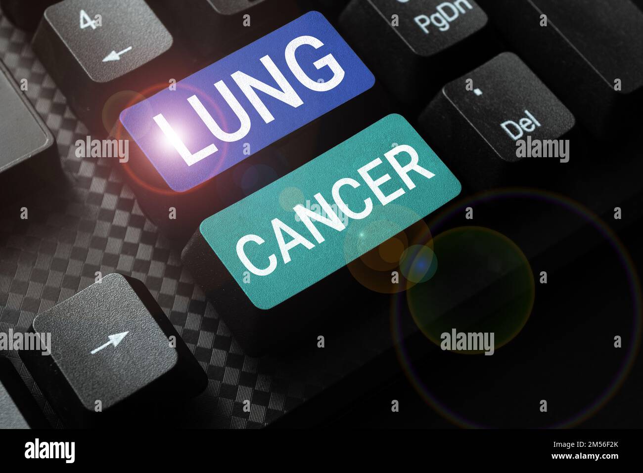 Handwriting Text Lung Cancer. Internet Concept Uncontrolled Growth Of 