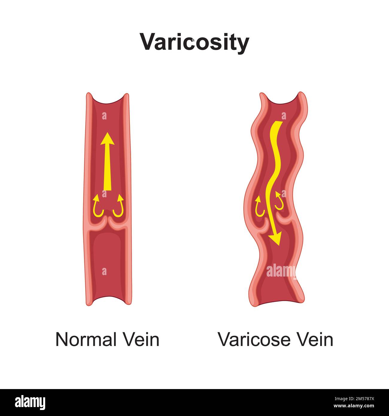 Vein Symbols
