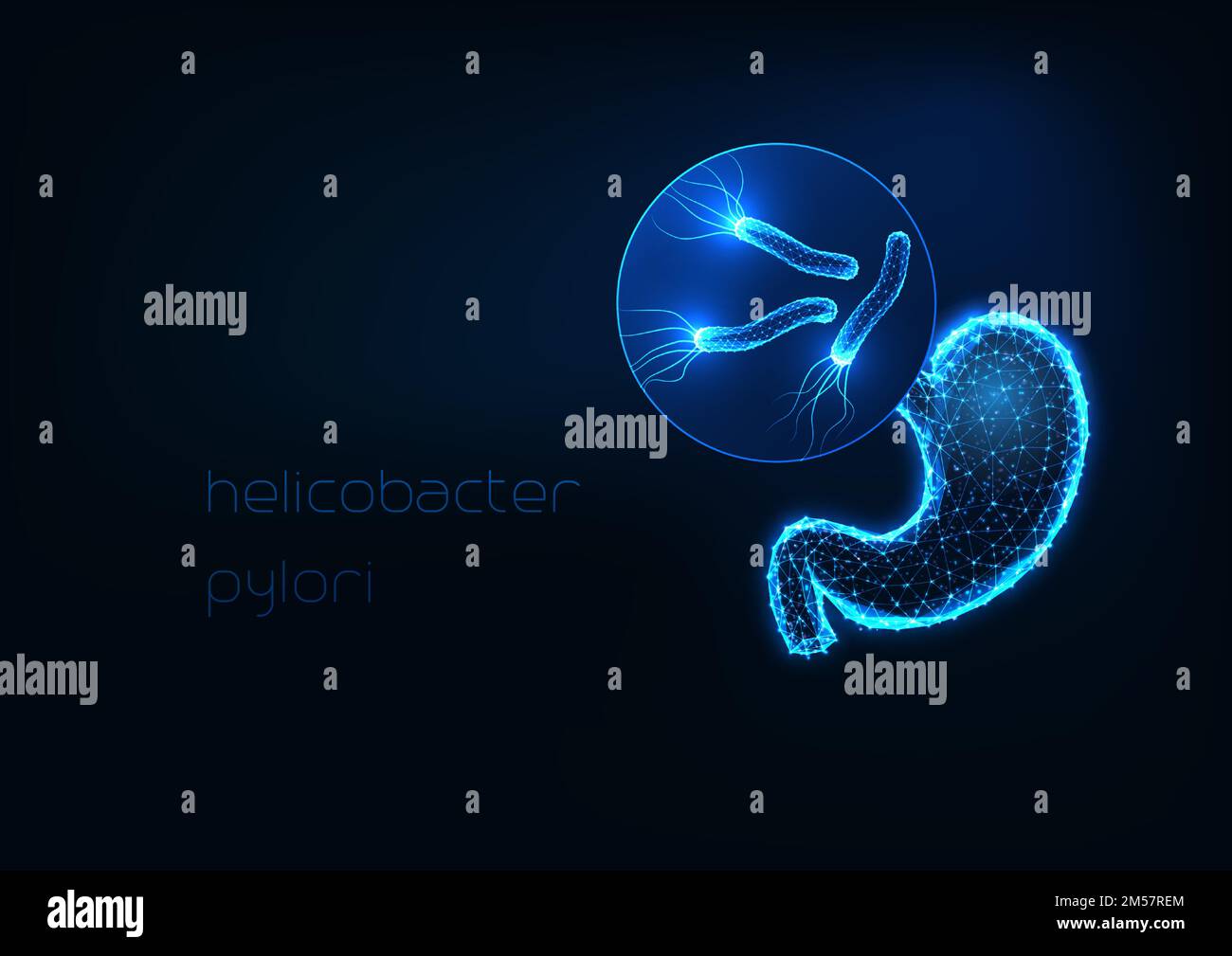 Futuristic stomach inflammation, gastritis concept with glowing low polygonal human stomach and helicobacter bacteria on dark blue background. Modern Stock Vector