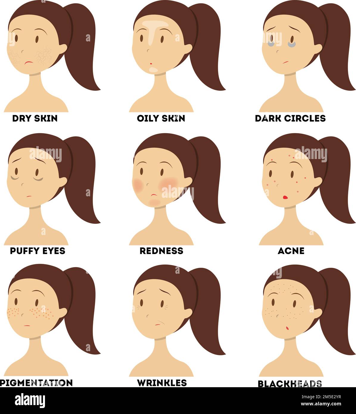Face Issue Problem Dark skin teen Stock Vector Images - Alamy