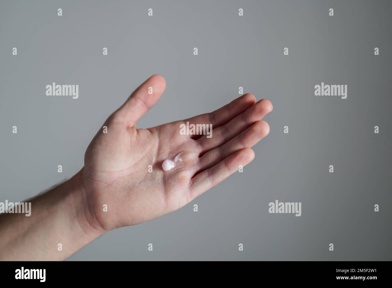Dry male hands. Man putting hand cream on his dry hands. Man applying