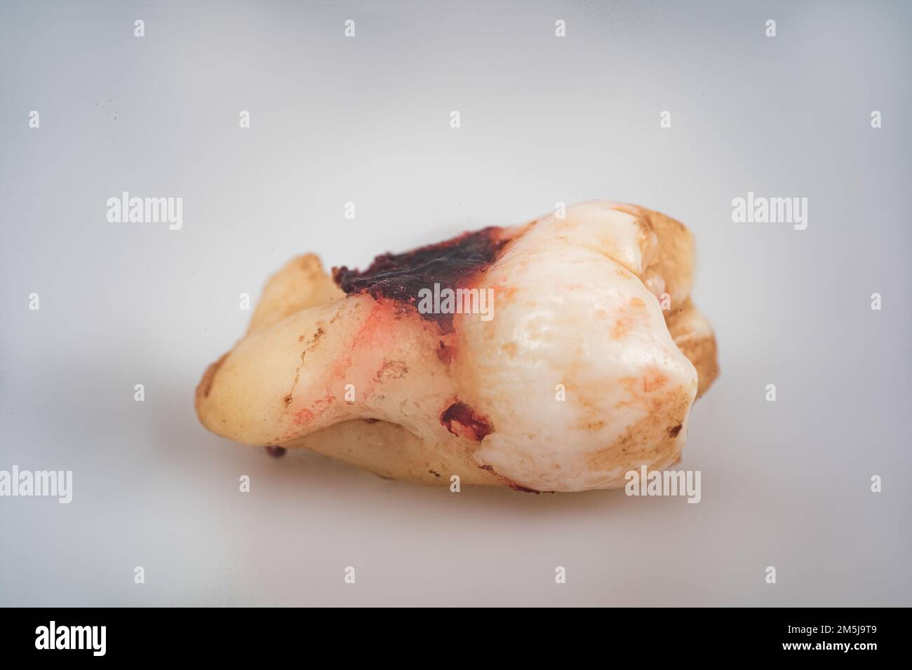 Human wisdom tooth isolated on gray background. Dentistry concept. Macro photo of a wisdom tooth close up Stock Photo