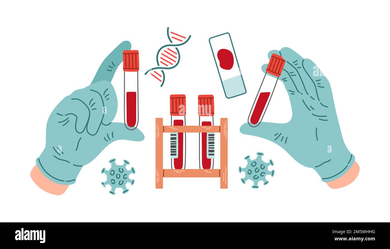Blood tube for testing in laboratory on viruses. Blood test for viral disease Covid-19 NCP. Stock Vector