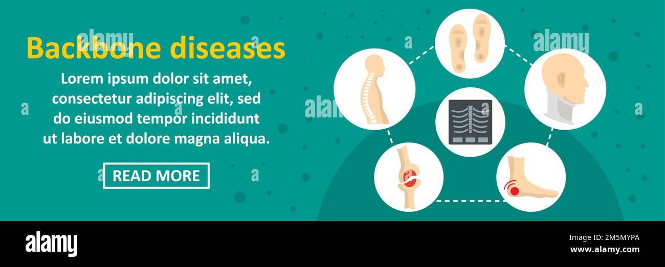 Backbone diseases banner horizontal concept. Flat illustration of