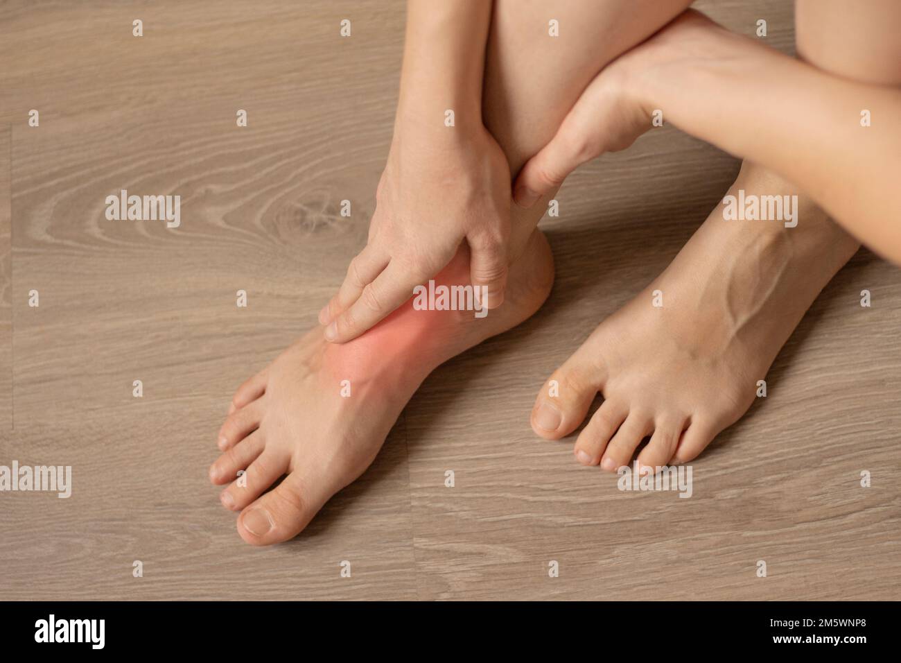 Pain in the legs. Women feet on the floor close up. Orthopedic Disease