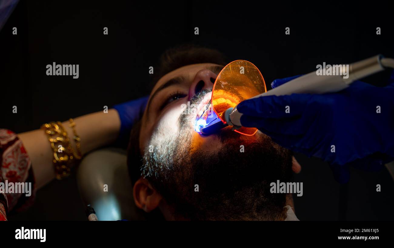 Tooth decay prevention. man in the dentist chair during a dental