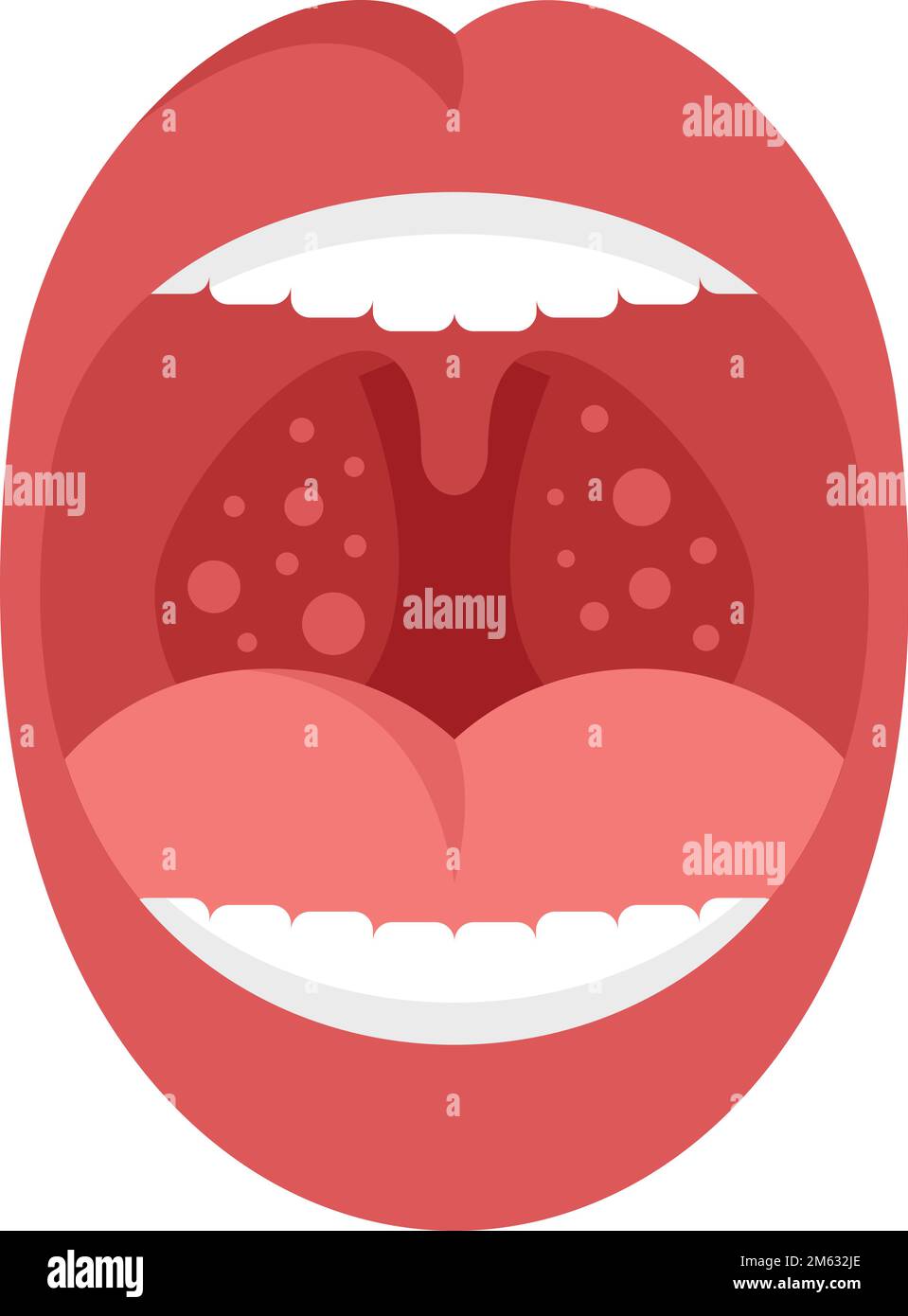 Mouth tonsillitis icon flat vector. Tonsil anatomy. Bacterial ent