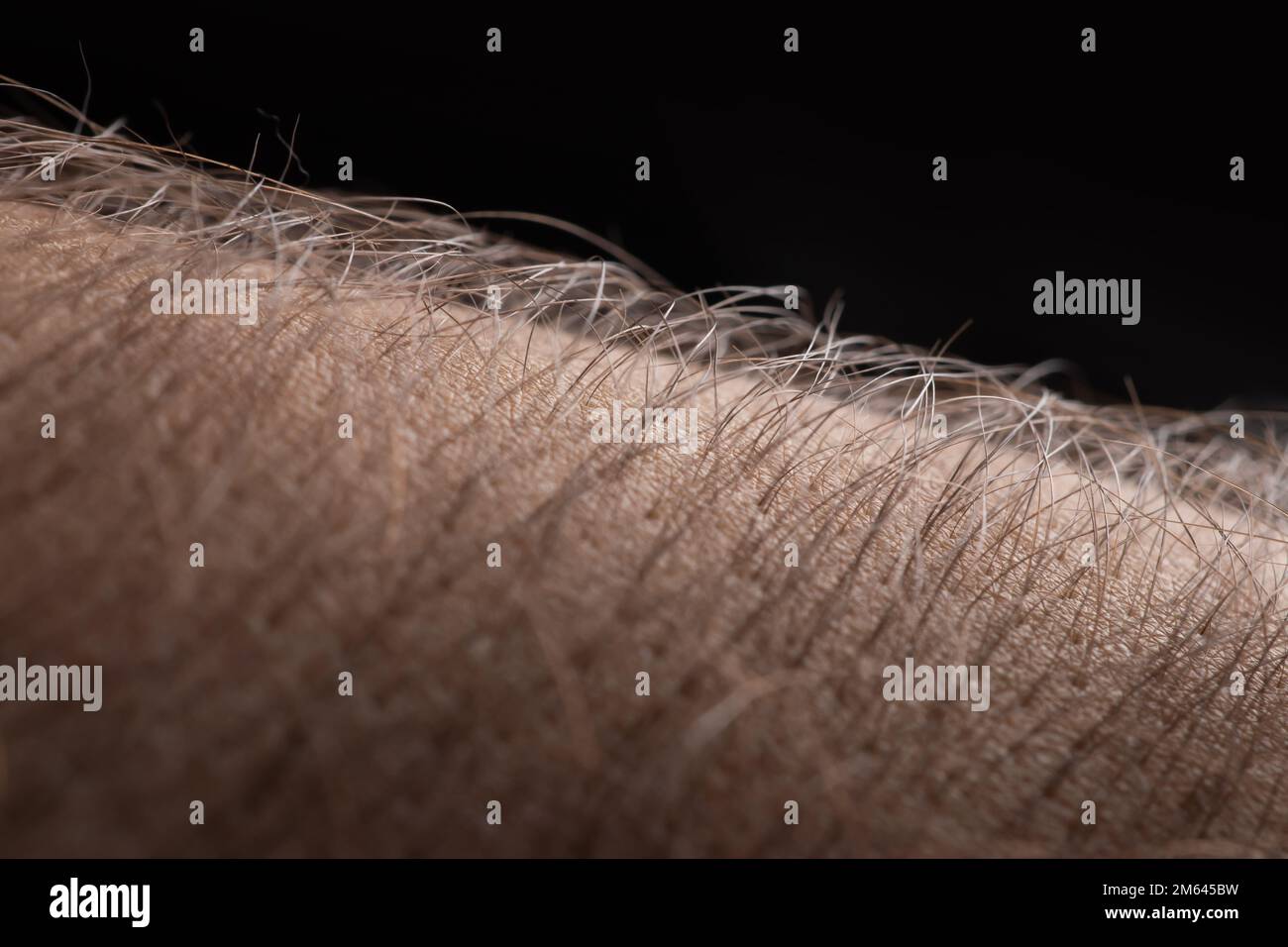 Goosebumps arm hires stock photography and images Alamy