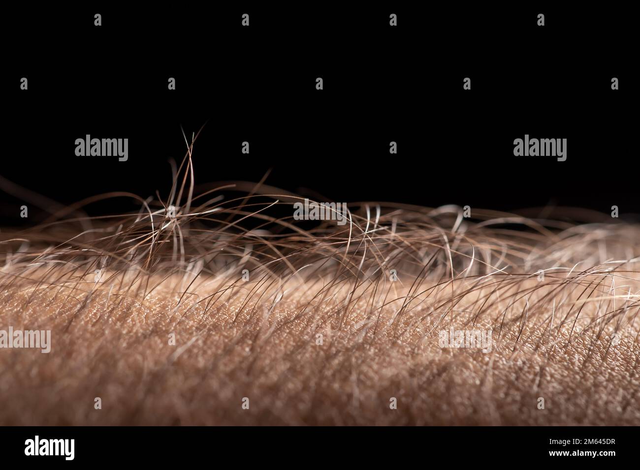 Woman with goose bumps on arm hires stock photography and images Alamy