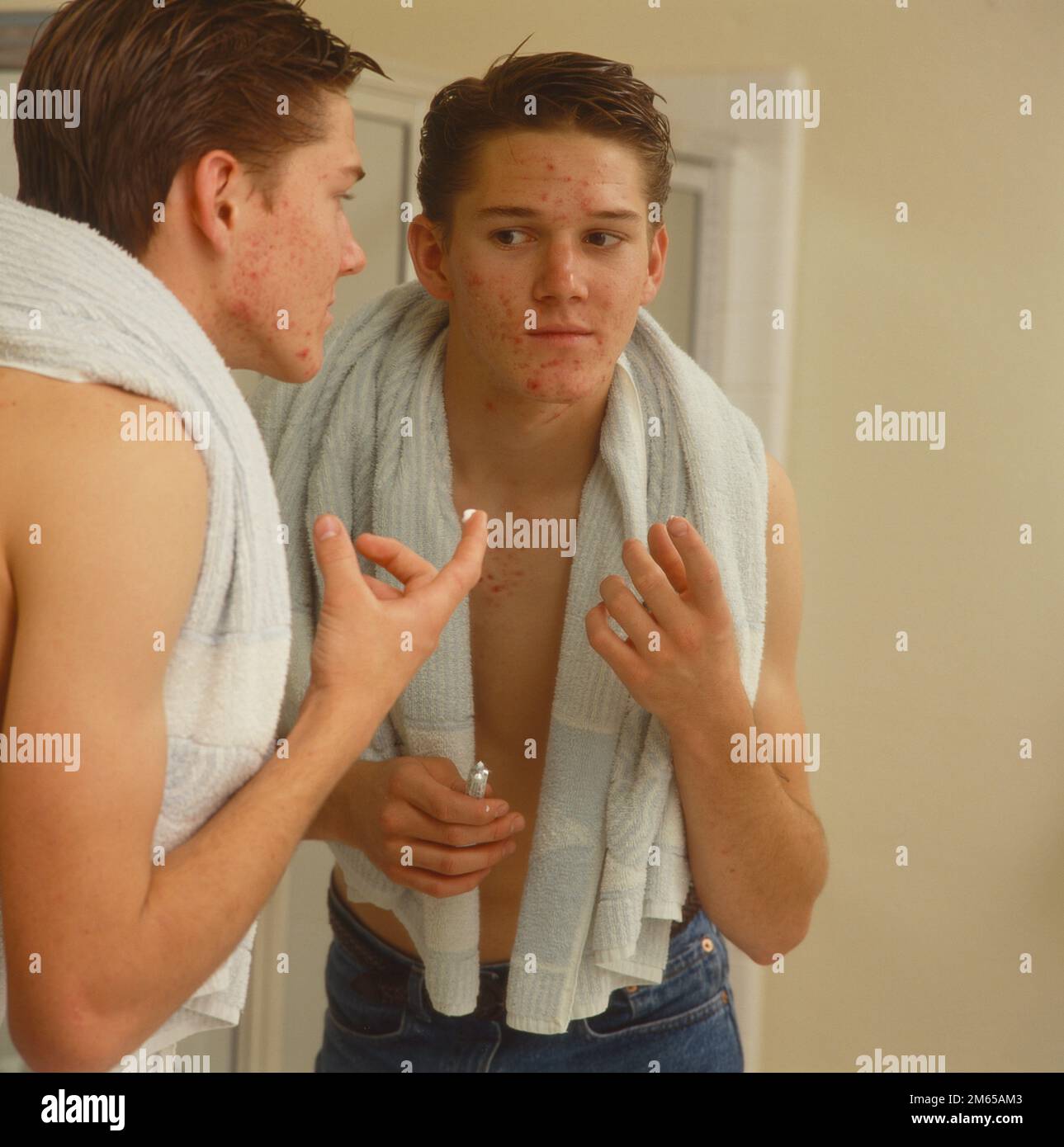 Teenage boy with bad acne problem standing in front of a mirror getting ready to apply medicine to his face Stock Photo
