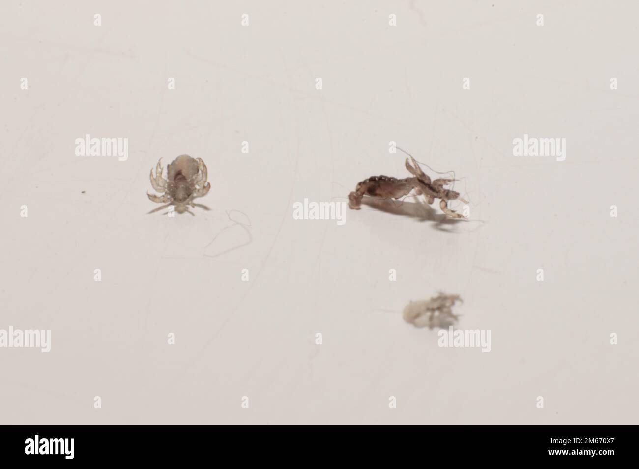 head louse males and females, kids and hair parasites. Macro photography of hair louse's. Pediculus humanus parasites. Small plagues. Hair plagues. Stock Photo
