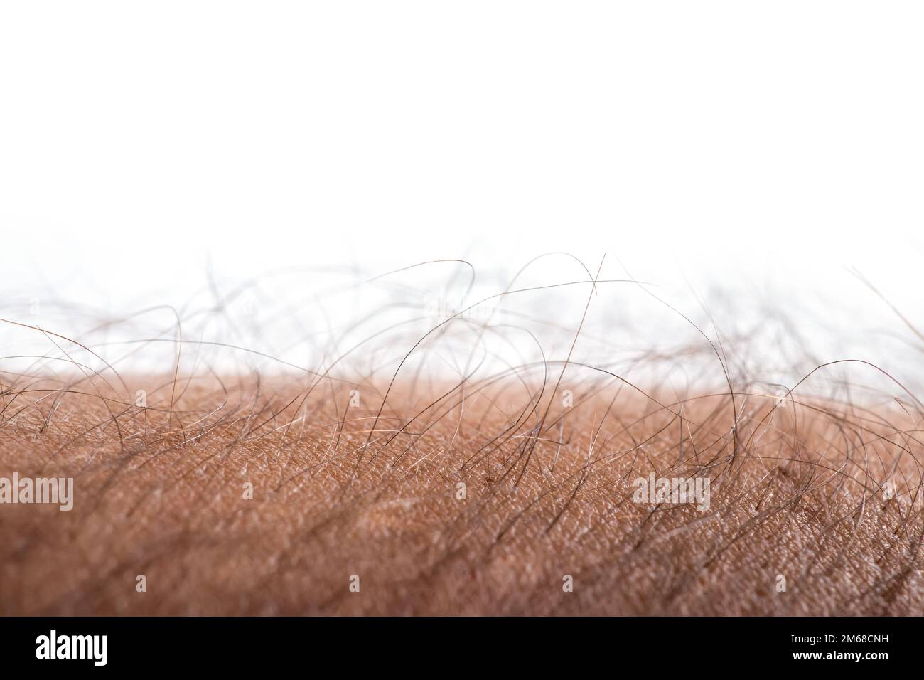 Woman with goose bumps on arm hires stock photography and images Alamy