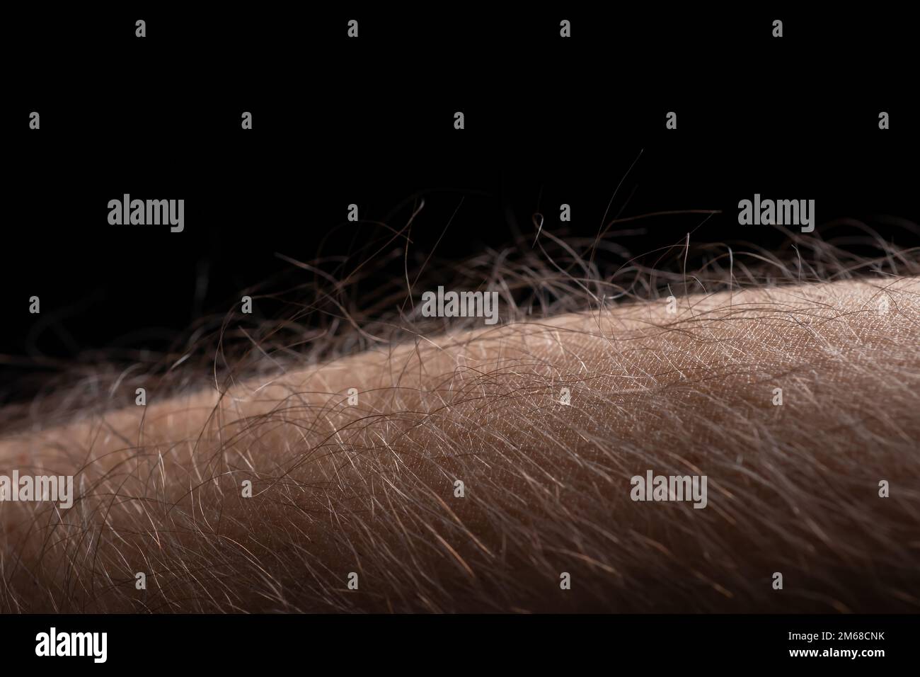 Hair on arm goose bumps hires stock photography and images Alamy