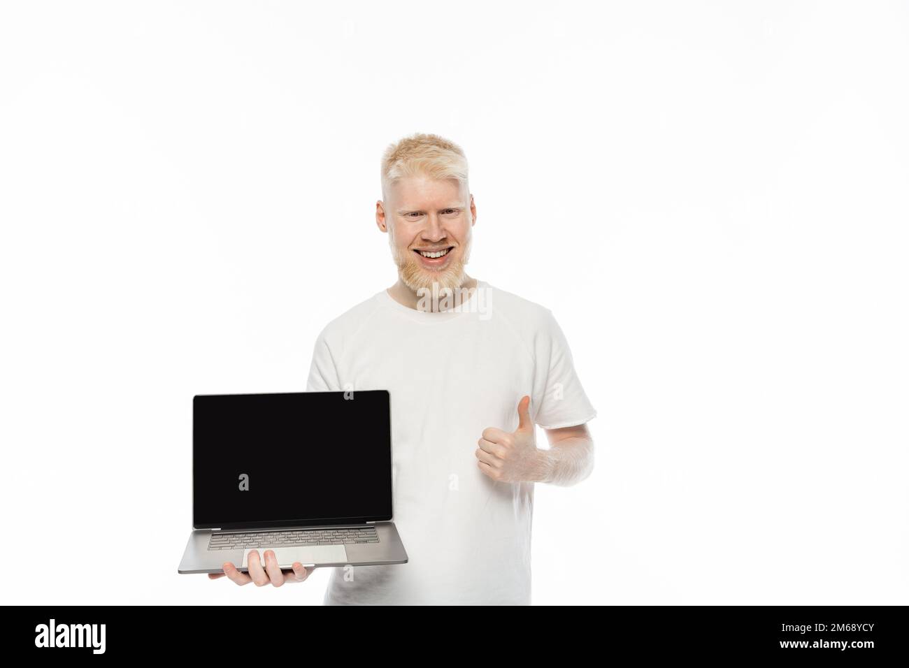 bearded albino man in t-shirt holding laptop with blank screen and ...