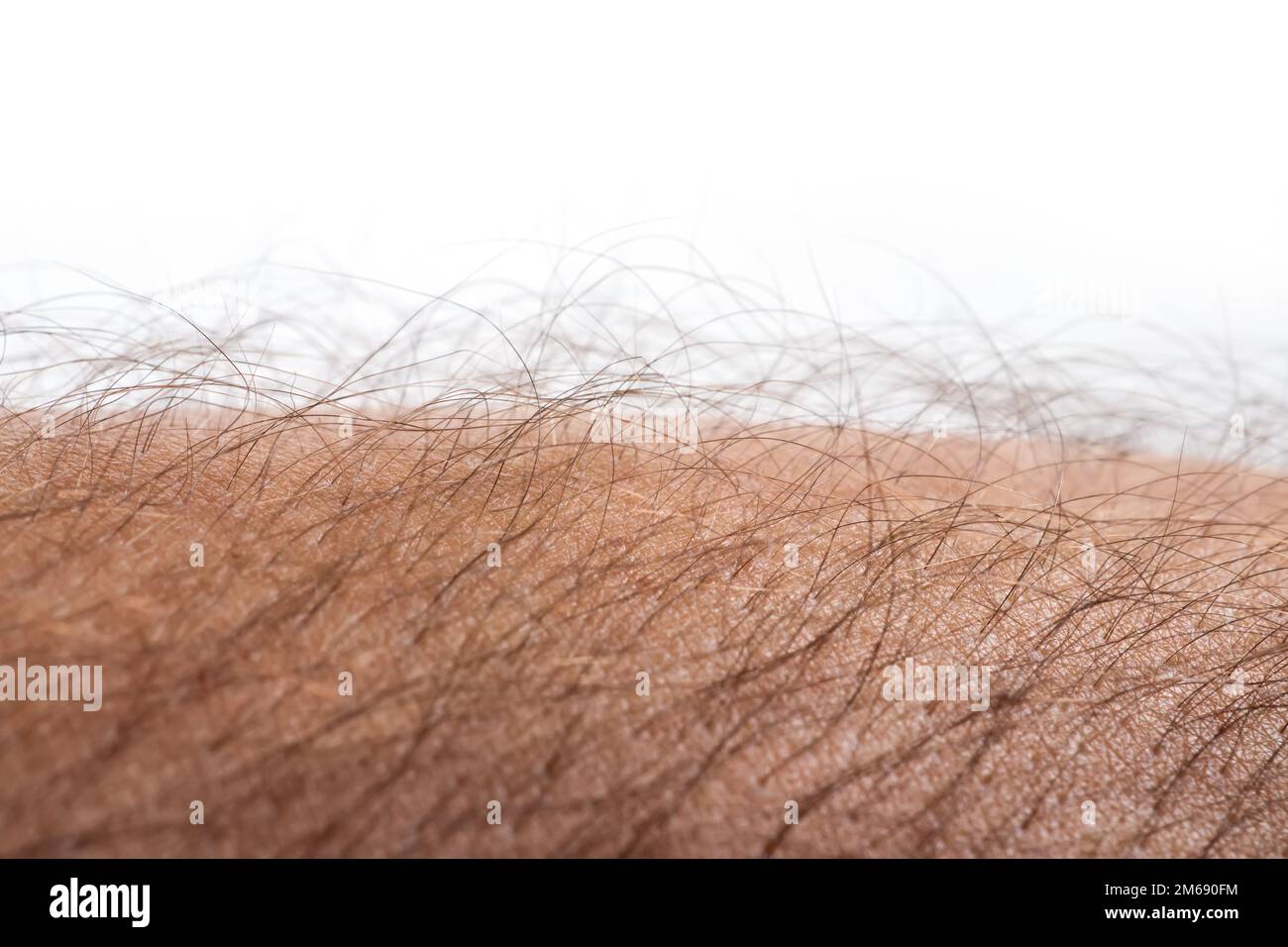 Woman with goose bumps on arm hires stock photography and images Alamy