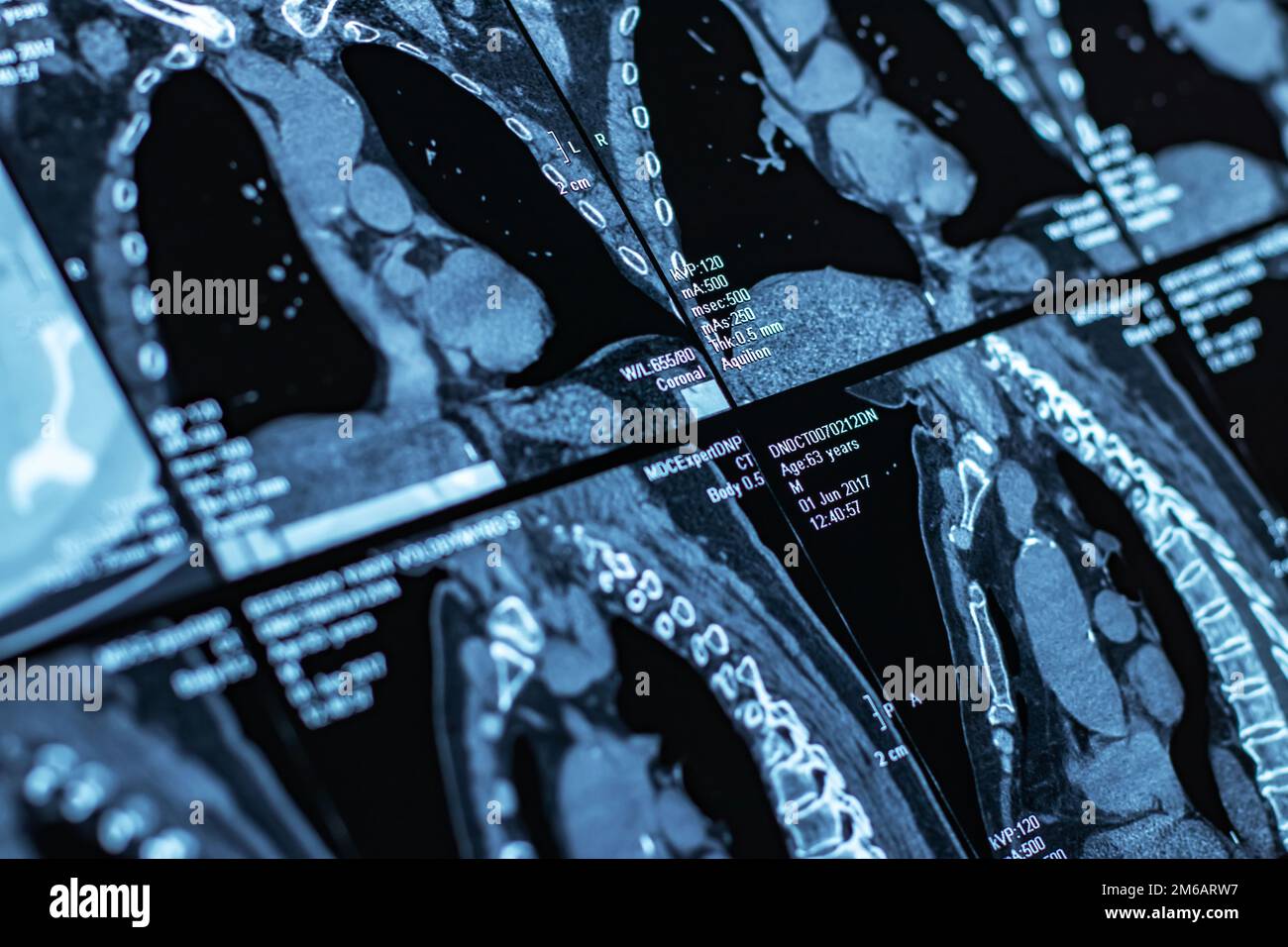 Close up of a body CT scan background. Stock Photo