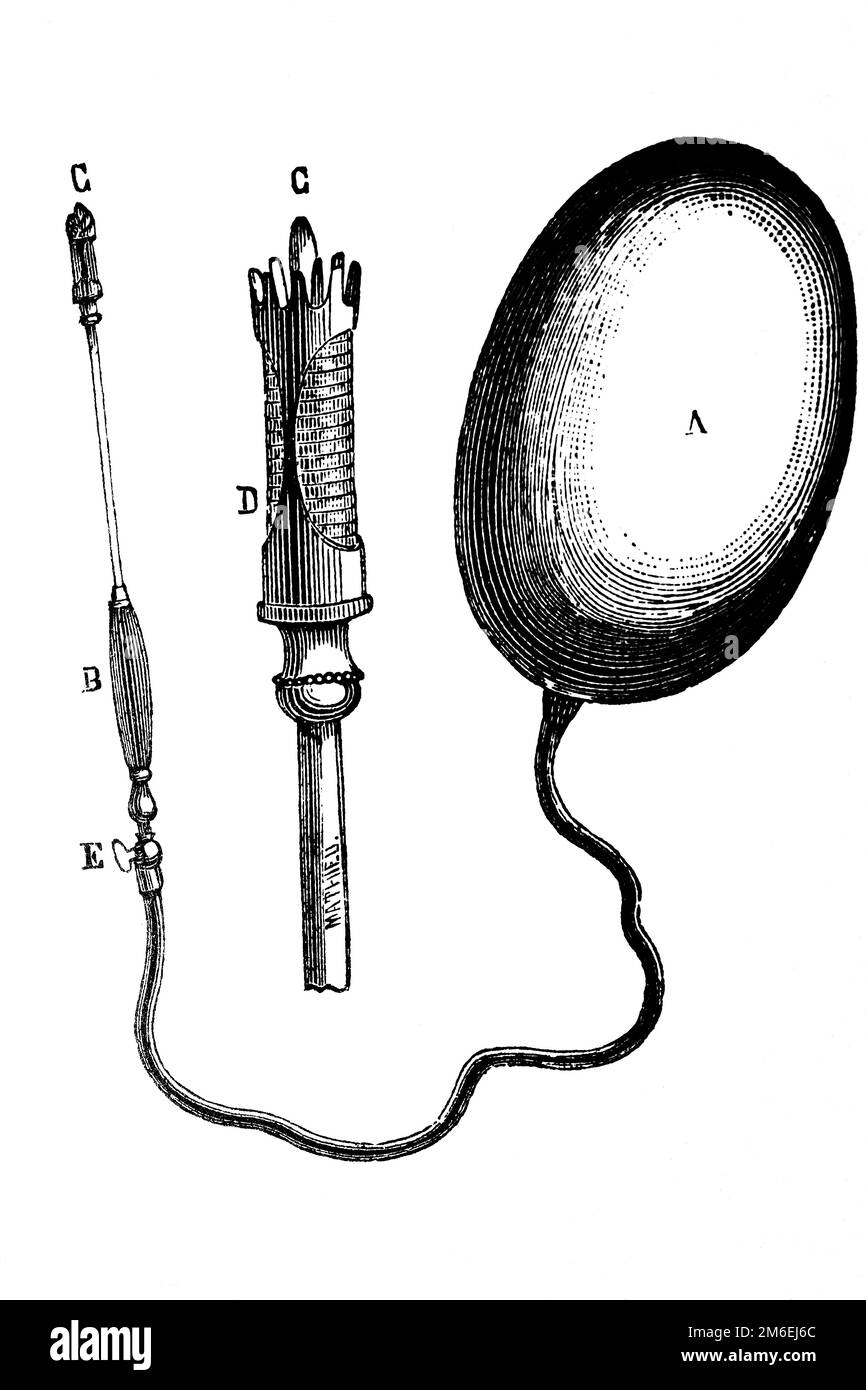 Cauterizer. Antique illustration from a medical book, 1889. Stock Photo