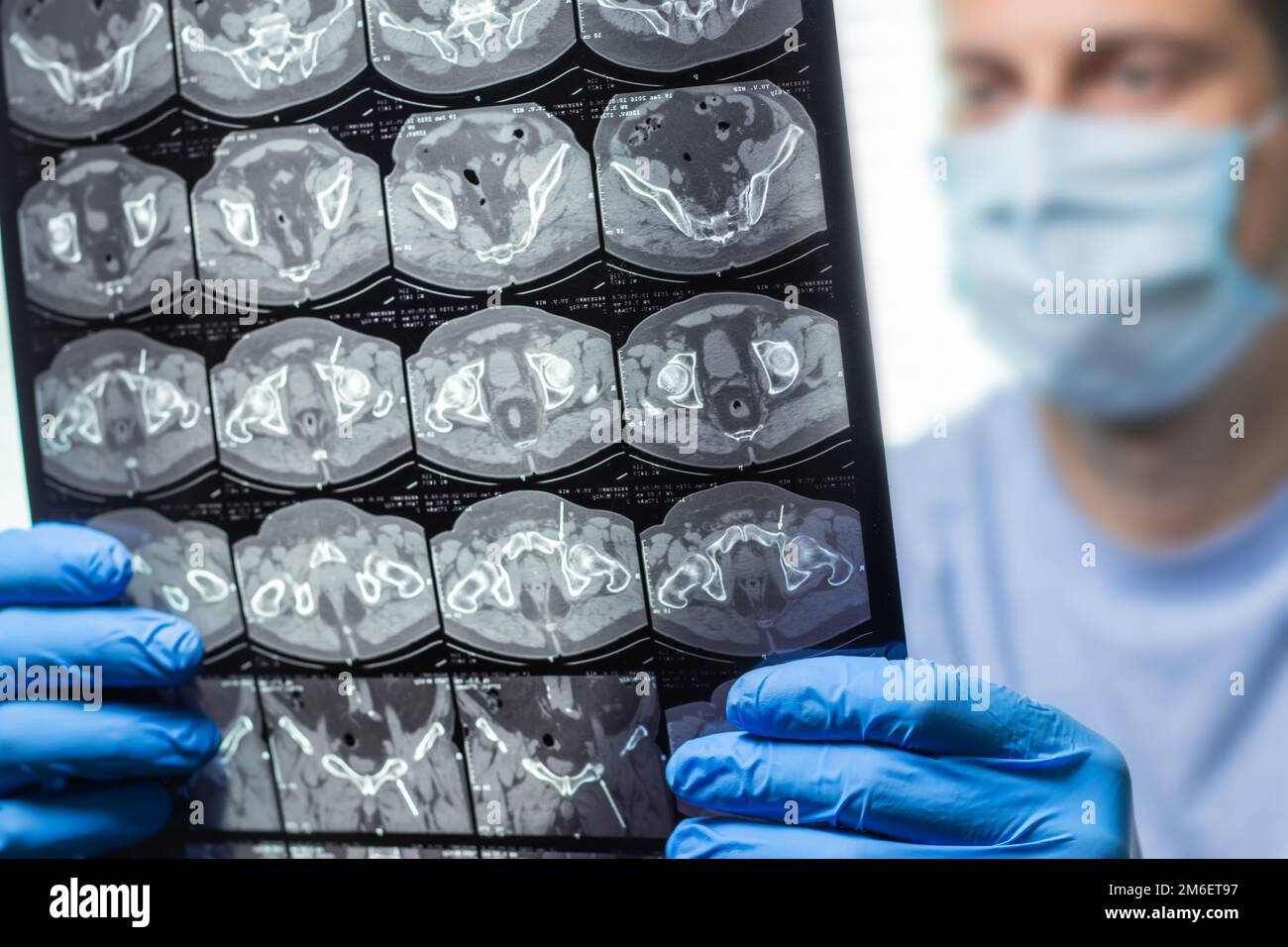 Doctor attentively examines the MRI scan of the patient Stock Photo - Alamy