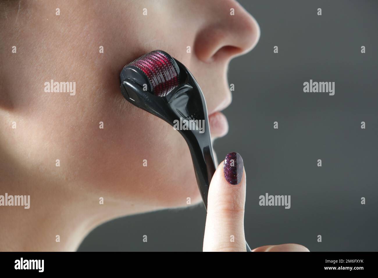 Facial massage with microneedle dermaroller for the treatment of scars