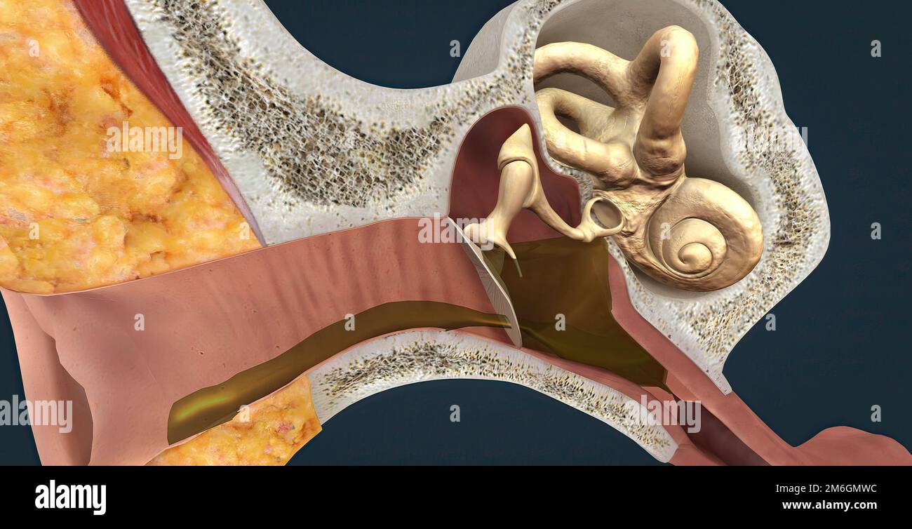 Inflammation behind the ear otitis hires stock photography and images