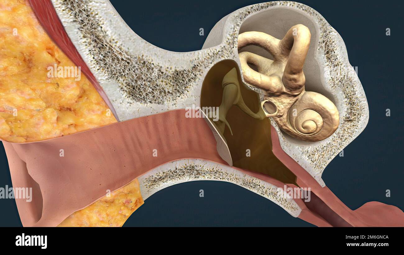 Inflammation behind the ear otitis hires stock photography and images Alamy