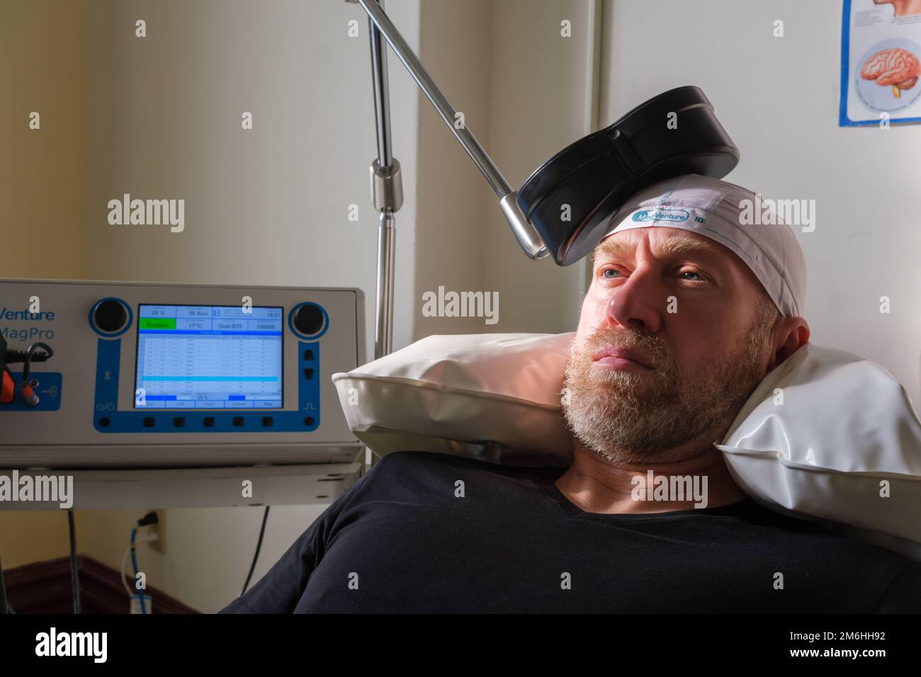 Montreal, CA - 15 november 2022: Patient undergoing Repetitive Transcranial Magnetic Stimulation (rTMS) to treat anxiety and depression Stock Photo