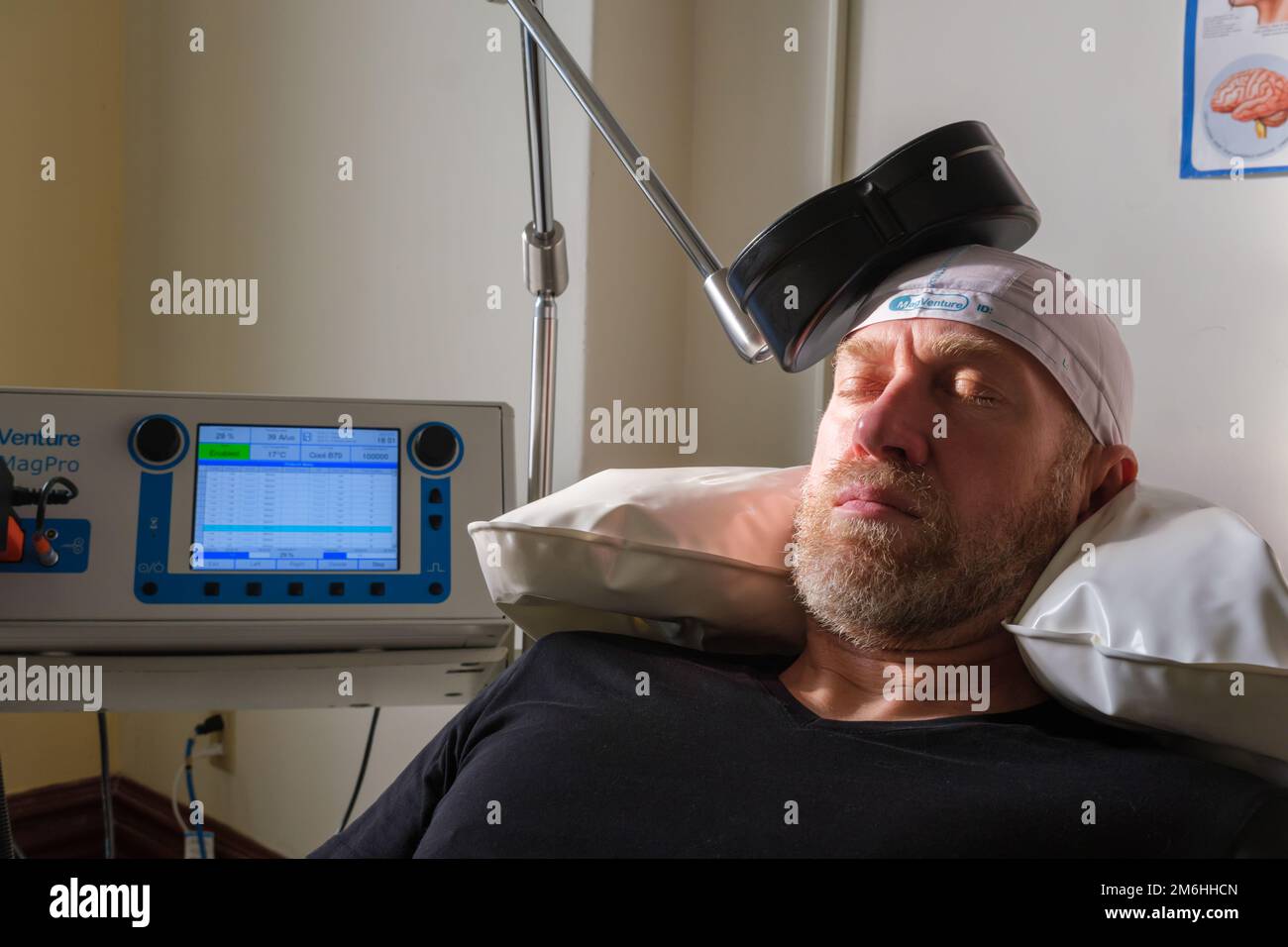 Montreal, CA - 15 november 2022: Patient undergoing Repetitive Transcranial Magnetic Stimulation (rTMS) to treat anxiety and depression Stock Photo