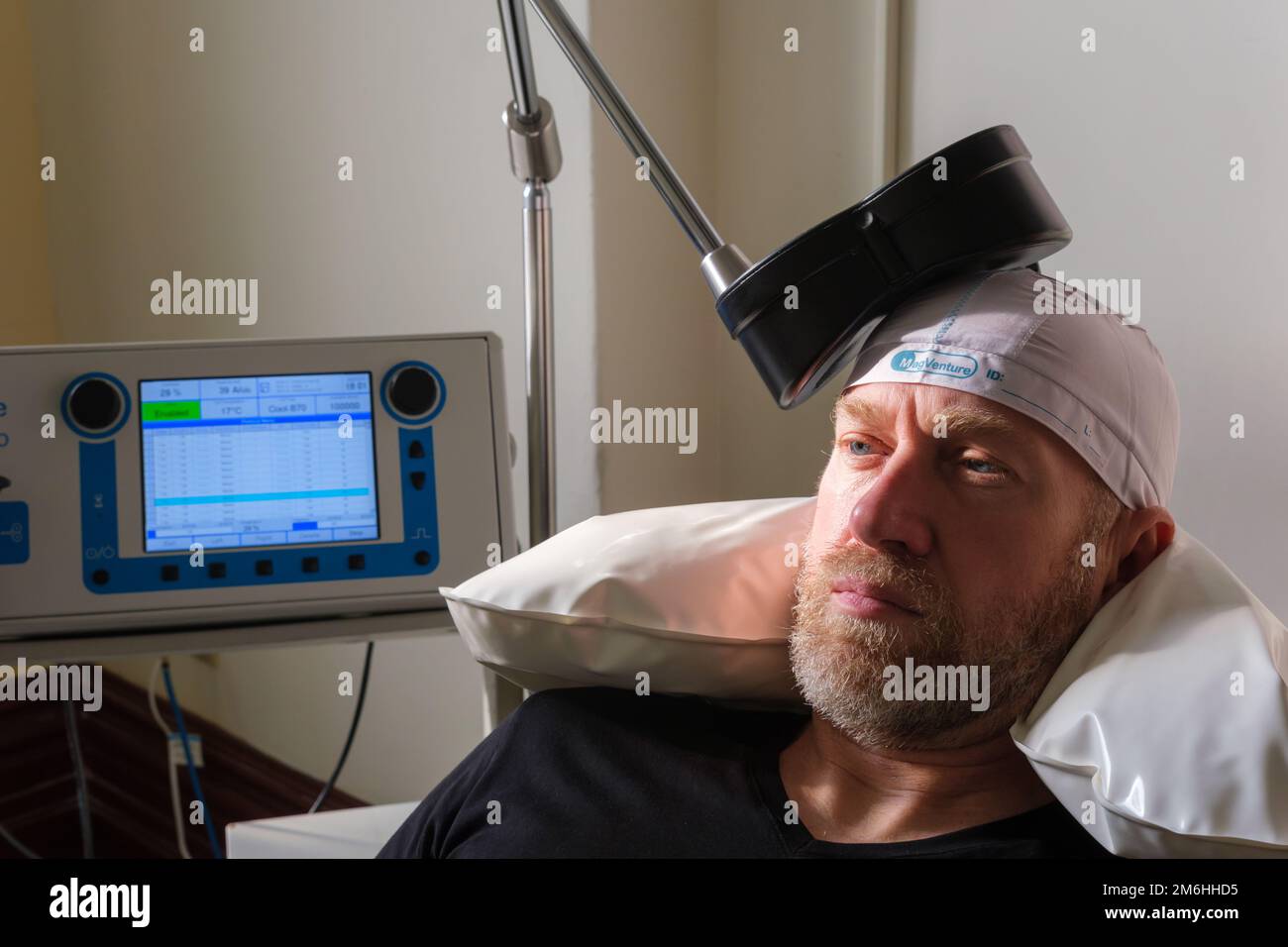 Montreal, CA - 15 november 2022: Patient undergoing Repetitive Transcranial Magnetic Stimulation (rTMS) to treat anxiety and depression Stock Photo