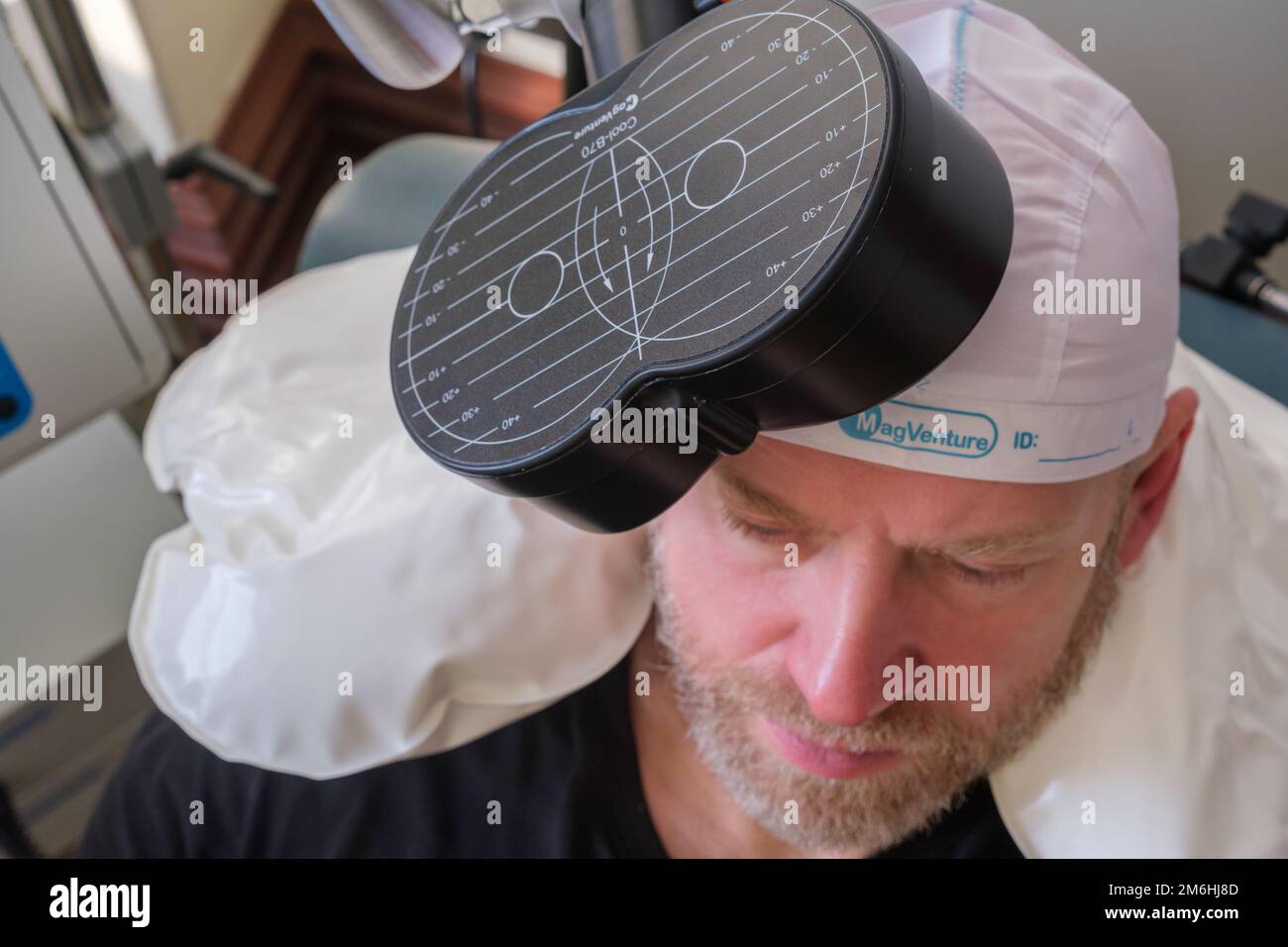 Montreal, CA - 15 november 2022: Patient undergoing Repetitive Transcranial Magnetic Stimulation (rTMS) to treat anxiety and depression Stock Photo