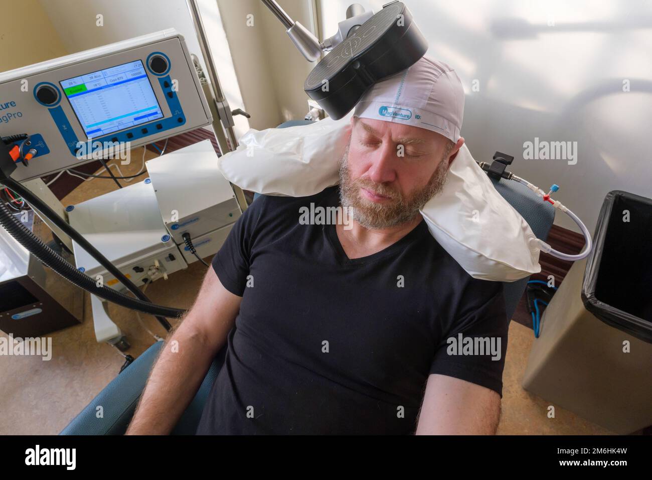Montreal, CA - 12 november 2022: Patient undergoing Repetitive Transcranial Magnetic Stimulation (rTMS) to treat anxiety and depression Stock Photo