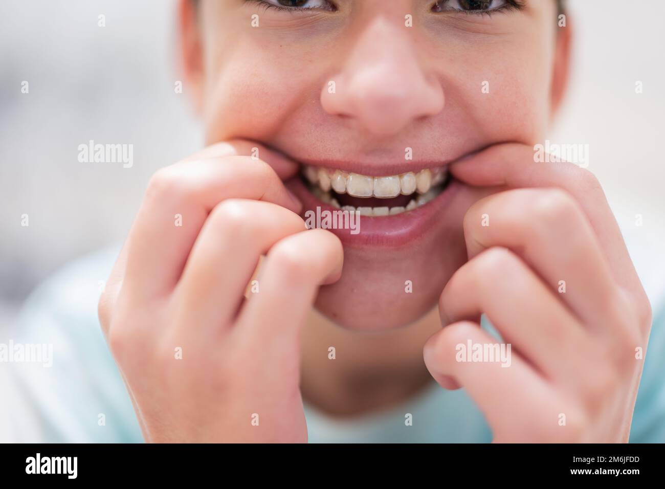 Teenager boy wear simulator orthodontic silicone invisible leveling