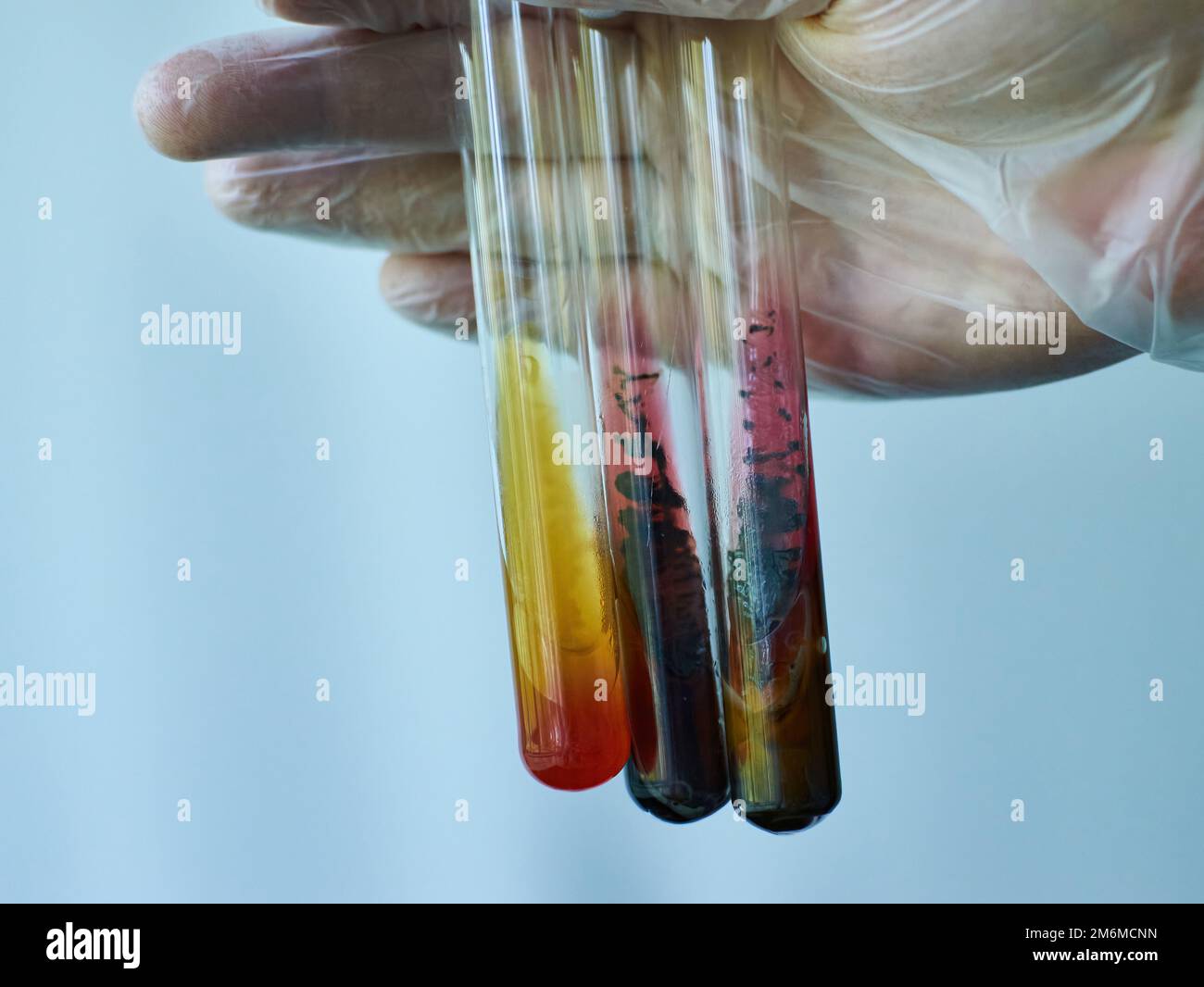 Various of Bacteria culture medium test tube microbiology laboratory