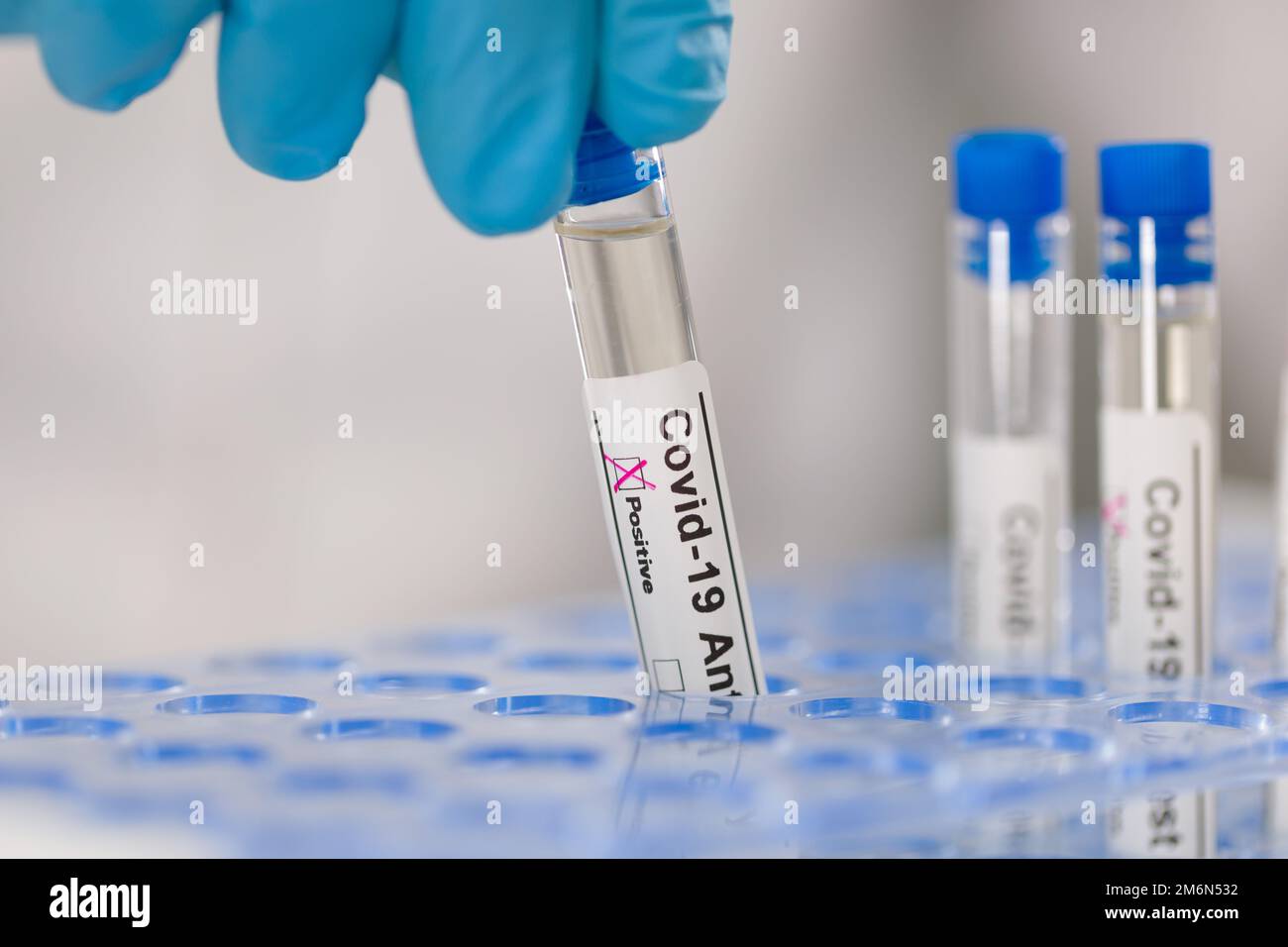 closeup of handling test tubes in a medical laboratory Stock Photo Alamy