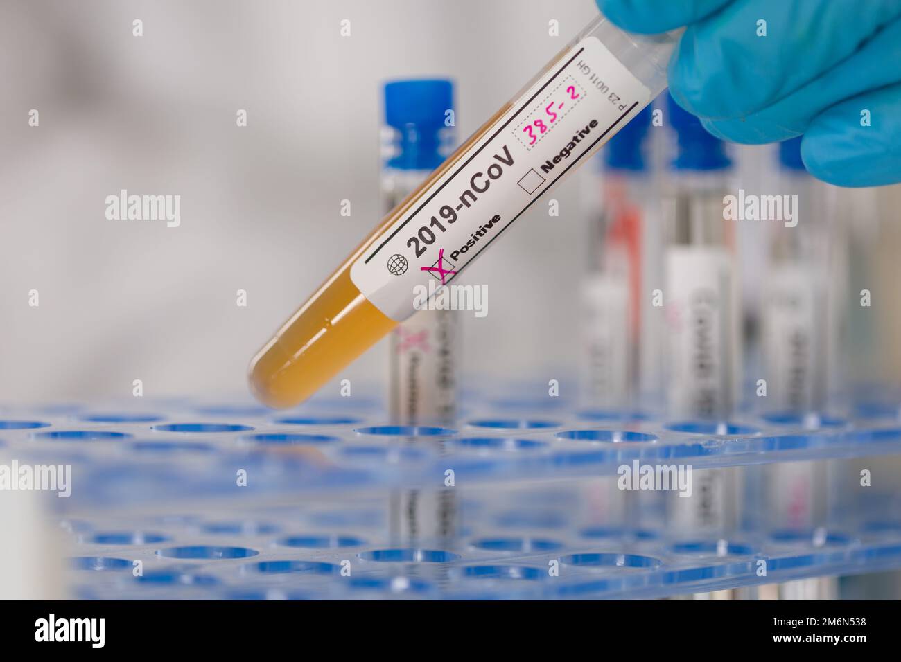 closeup of handling test tubes in a medical laboratory Stock Photo Alamy