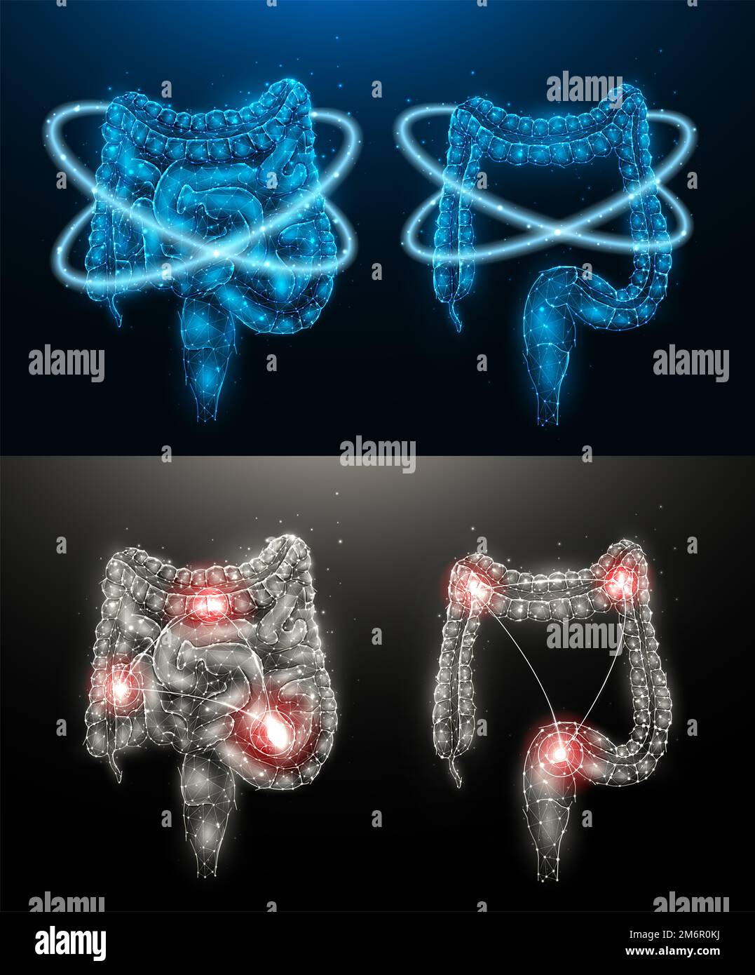 Polygonal vector illustration of an inflamed human intestine and recovery of intestinal function. Internal organs low poly desig Stock Photo