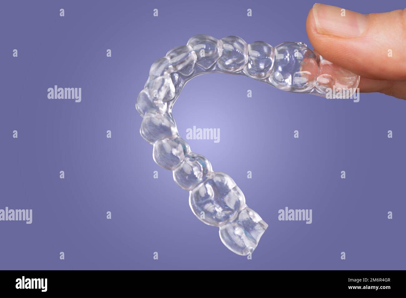 orthodontic treatment, invisible braces, new orthodontic technology