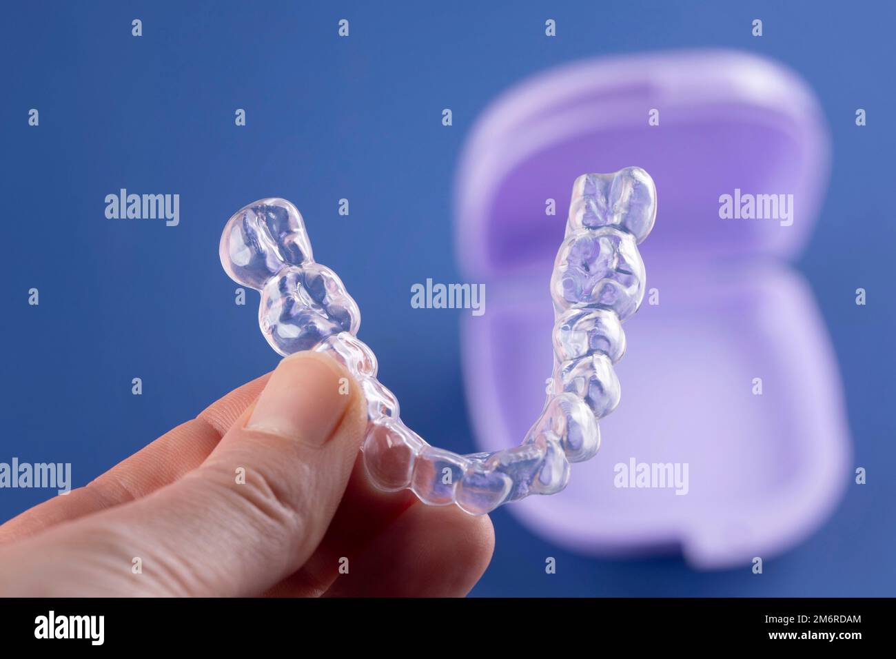 orthodontic treatment, invisible braces, new orthodontic technology, Occlusal Splint Stock Photo
