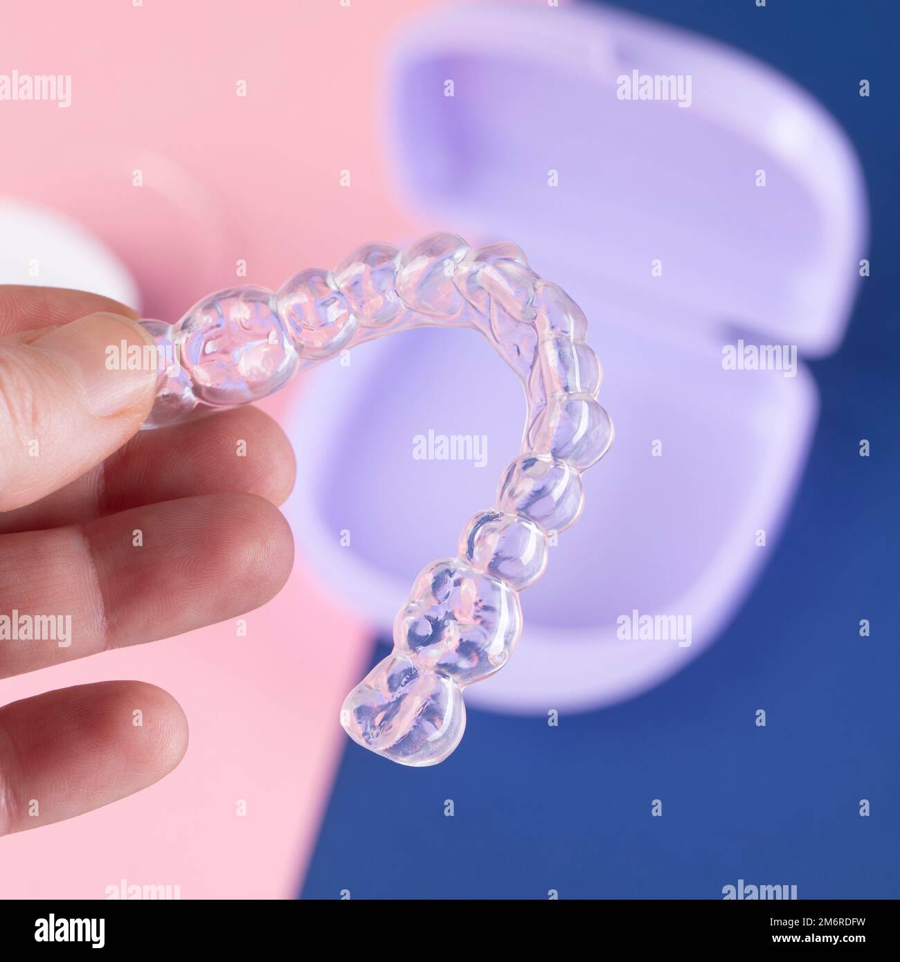 orthodontic treatment, invisible braces, new orthodontic technology