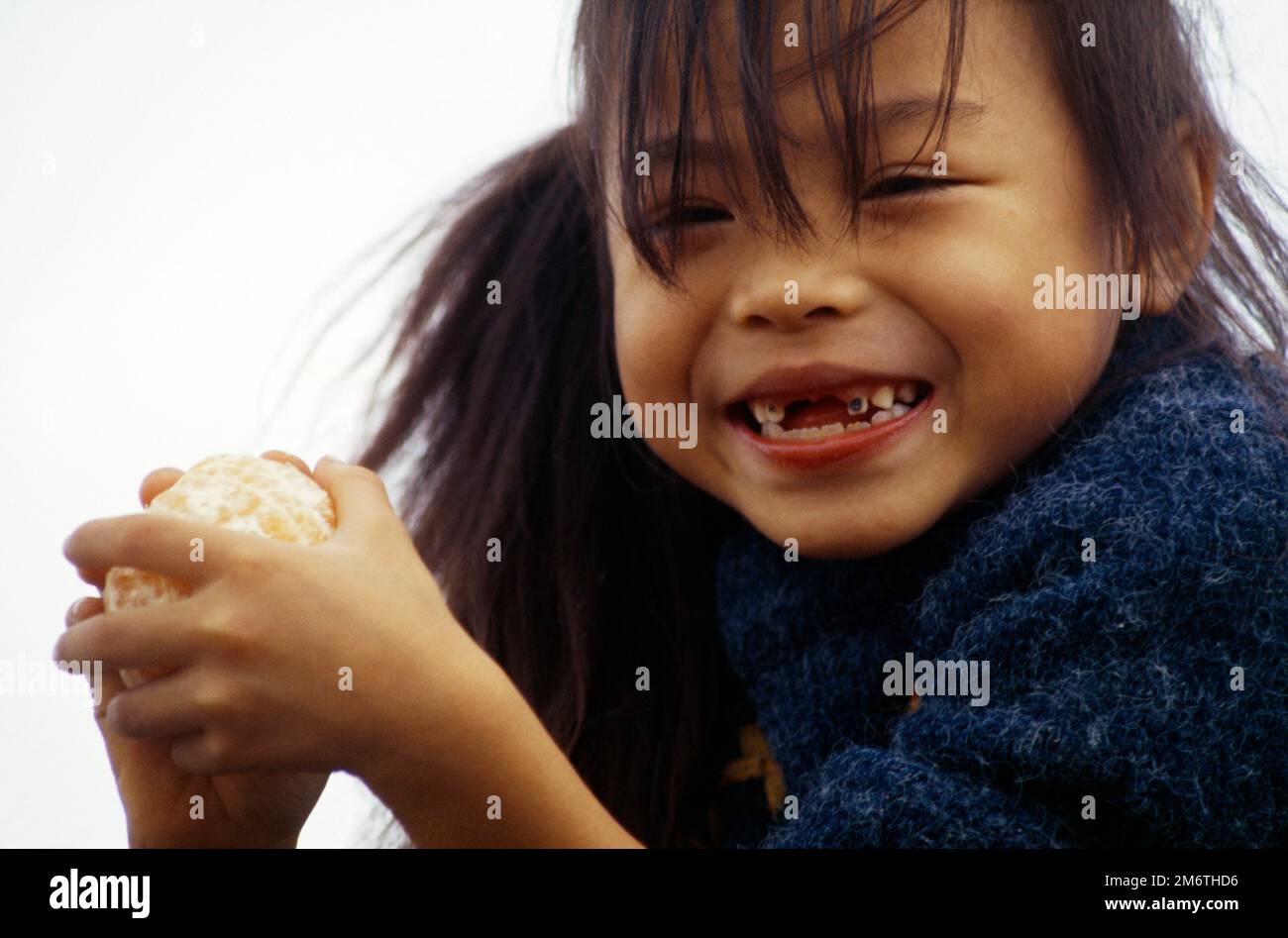 Missing teeth hi-res stock photography and images - Page 2 - Alamy