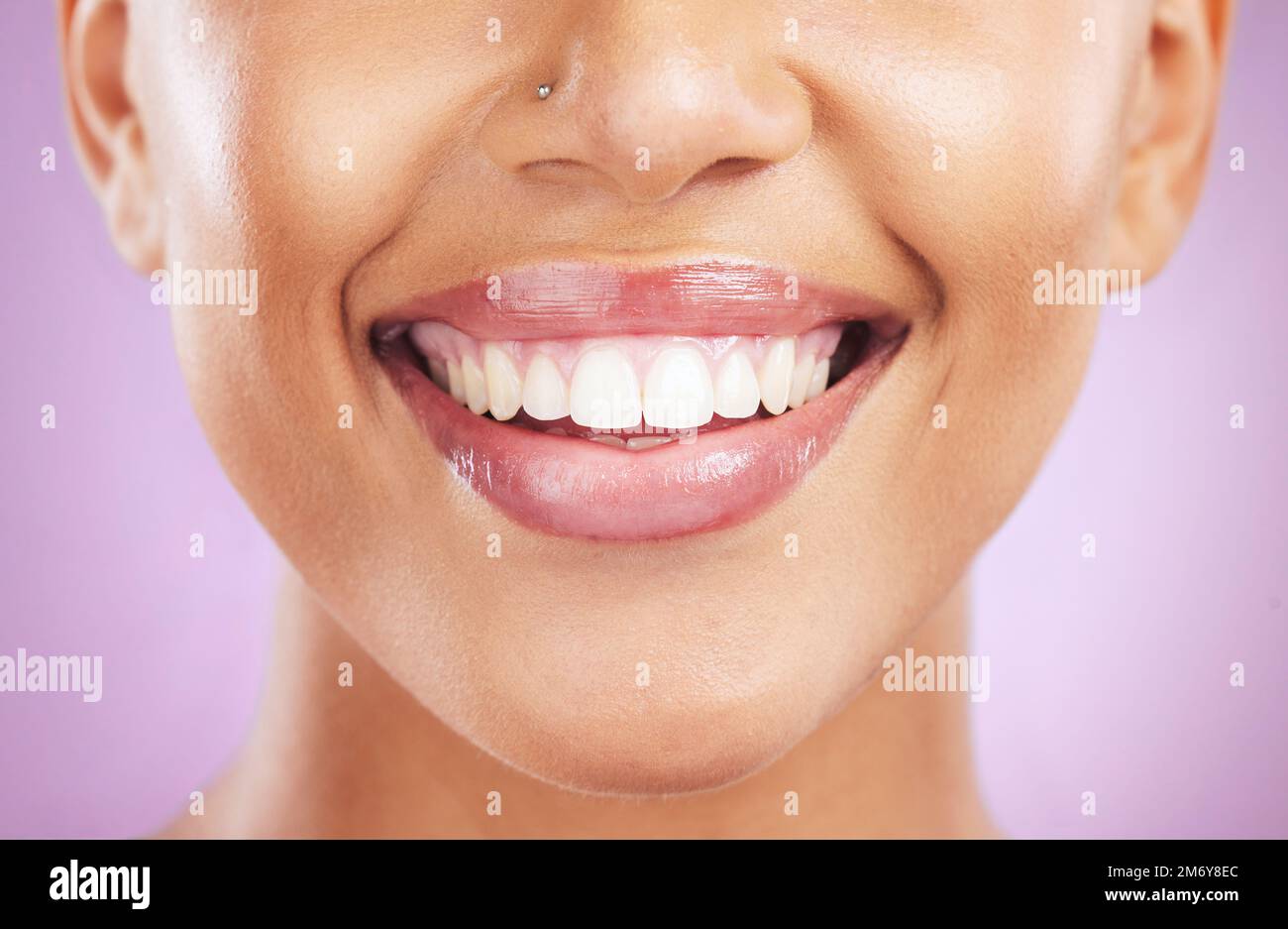Happy woman, face or dental care on purple studio background or teeth whitening, invisible braces treatment or grooming. Zoom on beauty model smile or Stock Photo