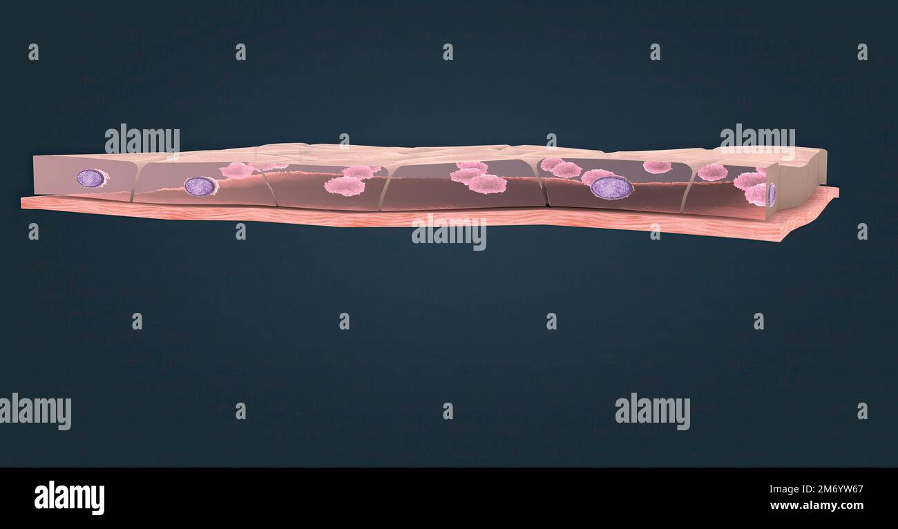 Simple squamous epithelium, this type of epithelium typically lines