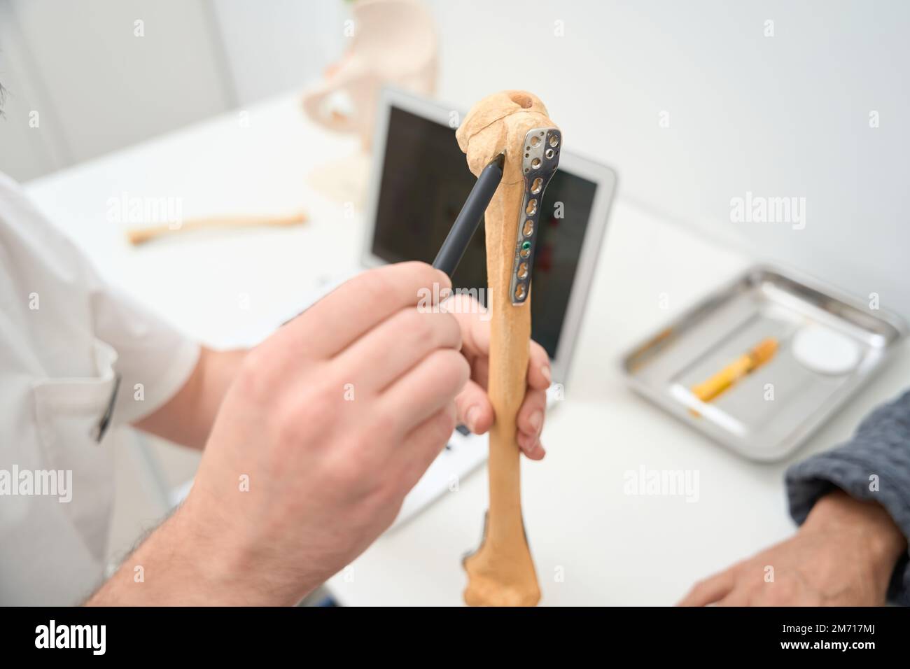 Human bone marrow hi-res stock photography and images - Alamy
